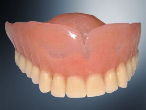 Upper Dentures Before And 
      After Pictures Richmond VA 23286